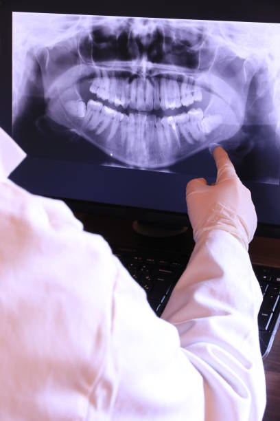 Best Emergency Dental Extractions in Combes, TX