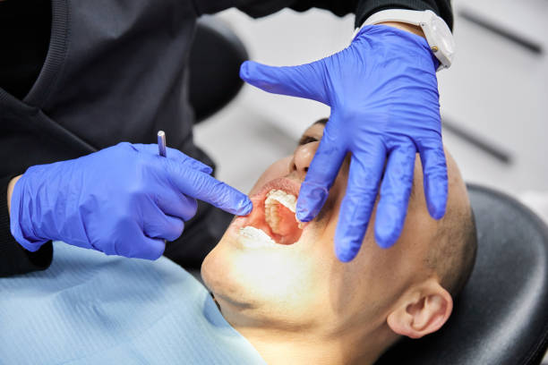 Best Emergency Dentist for Knocked-Out Tooth in Combes, TX